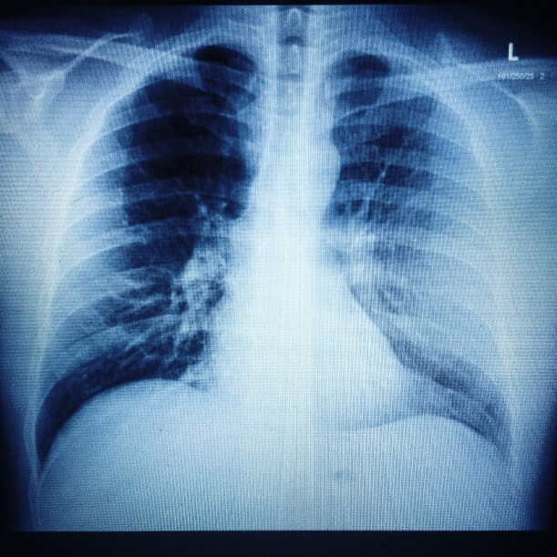 GQQydv_t20_x66k72 (1)