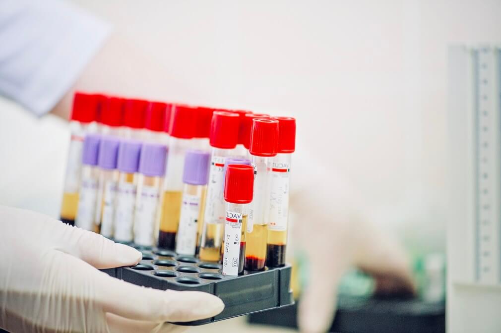 vaccination-vaccinated-vaccine-vaccine-development-influenza-vaccine-coronavirus-corona-virus-covid_t20_Xv8AAl (1)